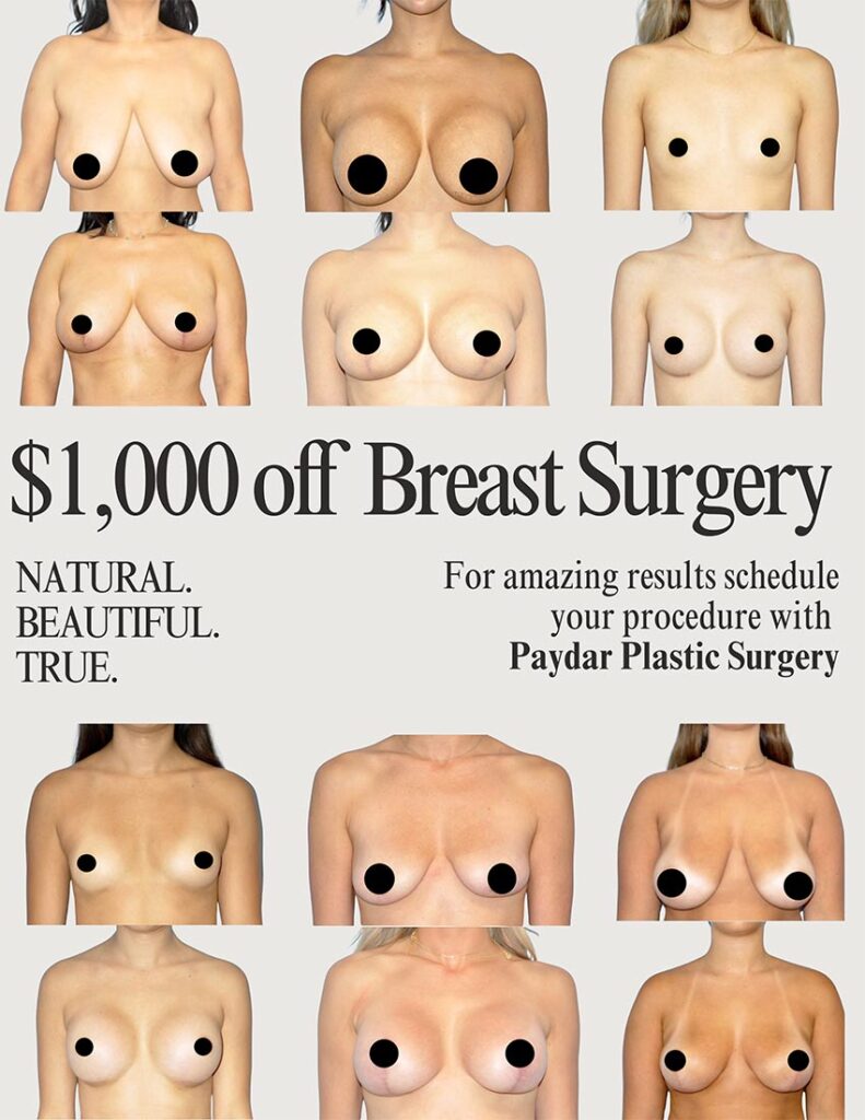 Breast Augmentation special offer in Newport Beach